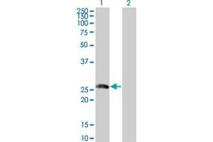 Western Blot analysis of BTG4 expression in transfected 293T cell line by BTG4 monoclonal antibody (M07), clone 1A6.