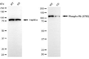 Western blotting analysis using phospho-Rb (S780) antibody (ABIN7800187). (Recombinant Retinoblastoma Protein (Rb) 抗体  (pSer780))