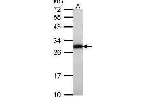 WB Image Sample (30 ug of whole cell lysate) A: Raji 12% SDS PAGE GRB2 antibody antibody diluted at 1:1000 (GRB2 抗体  (C-Term))
