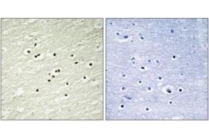 Immunohistochemistry analysis of paraffin-embedded human brain tissue, using Cyclin H (Ab-315) Antibody. (Cyclin H 抗体  (AA 274-323))