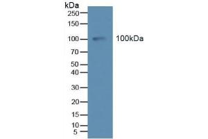 Detection of Tie2 in Human Serum using Polyclonal Antibody to TEK Tyrosine Kinase, Endothelial (Tie2) (TEK 抗体  (AA 286-465))