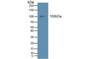 Detection of Tie2 in Human Serum using Polyclonal Antibody to TEK Tyrosine Kinase, Endothelial (Tie2)