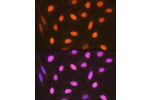 Immunofluorescence analysis of U-2 OS cells using HMGB2 Rabbit mAb (ABIN7267649) at dilution of 1:100 (40x lens). (HMGB2 抗体)