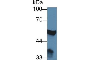 Detection of ABAT in Rat Cerebrum lysate using Polyclonal Antibody to 4-Aminobutyrate Aminotransferase (ABAT) (ABAT 抗体  (AA 236-500))