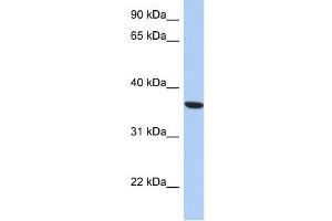 PSTK antibody used at 1 ug/ml to detect target protein. (PSTK 抗体  (Middle Region))