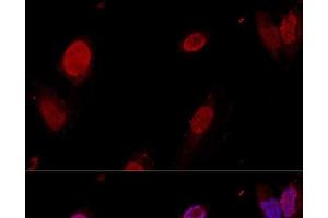 Confocal immunofluorescence analysis of U-2OS cells using PTBP1 Polyclonal Antibody at dilution of 1:50. (PTBP1 抗体)