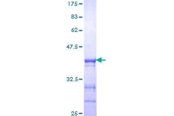 CLOCK Protein (AA 497-596) (GST tag)