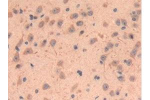 Immunohistochemistry (IHC) image for anti-Lysyl Oxidase-Like 3 (LOXL3) (AA 509-712) antibody (ABIN7439201)
