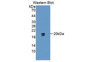 Detection of Recombinant GYPA, Mouse using Polyclonal Antibody to Glycophorin A (GYPA) (CD235a/GYPA 抗体  (AA 1-108))