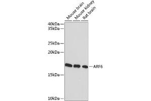 Western blot analysis of extracts of various cell lines, using  Rabbit mAb (ABIN7265485) at 1:1000 dilution.