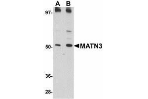 Image no. 1 for anti-Matrilin 3 (MATN3) (C-Term) antibody (ABIN478072) (Matrilin 3 抗体  (C-Term))