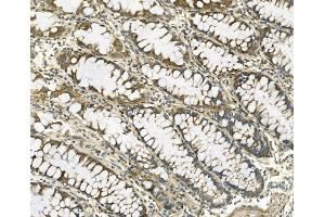IHC analysis of Galectin 2/LGALS2 using anti-Galectin 2/LGALS2 antibody (ABIN7598979).
