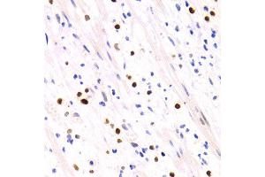 Immunohistochemistry of paraffin-embedded human appendicitis using GEMIN2 antibody at dilution of 1:200 (400x lens). (SIP1 抗体)