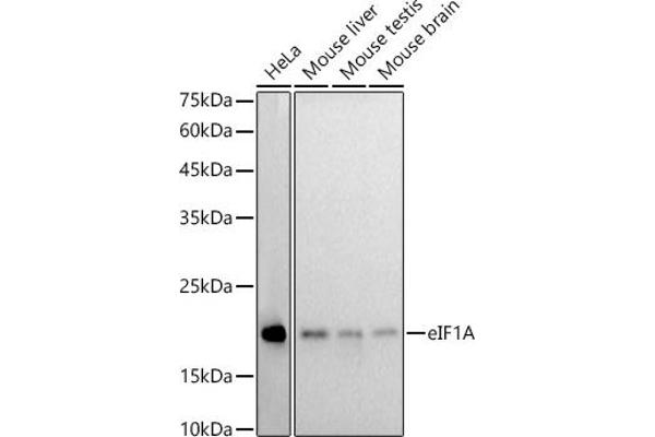 Eukaryotic Translation Initiation Factor 1A (EIF1A) 抗体