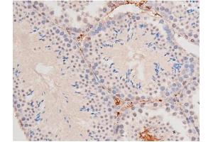 Immunohistochemistry (IHC) image for anti-Mast/stem Cell Growth Factor Receptor (KIT) (pTyr703) antibody (ABIN6255994)