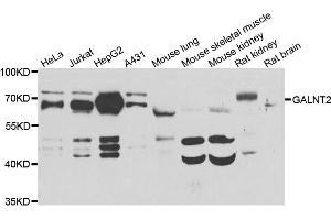 Western blot analysis of extracts of various cell lines, using GALNT2 antibody (ABIN5974158) at 1/1000 dilution. (GALNT2 抗体)