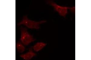 ABIN6275055 staining HepG2 by IF/ICC. (DHRS4 抗体  (C-Term))