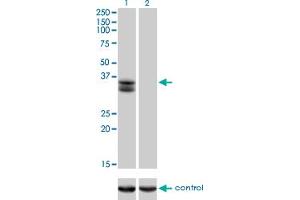 Western blot analysis of SIX2 over-expressed 293 cell line, cotransfected with SIX2 Validated Chimera RNAi (Lane 2) or non-transfected control (Lane 1).