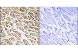 Immunohistochemistry (IHC) image for anti-Mitochondrial Ribosomal Protein L39 (MRPL39) (AA 289-338) antibody (ABIN2890417) (MRPL39 抗体  (AA 289-338))