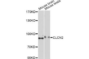 Western blot analysis of extracts of various cell lines, using CLCN2 Antibody. (CLCN2 抗体)