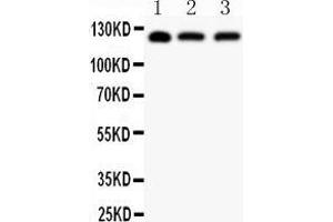 Anti-SIRT1 Picoband antibody,  All lanes: Anti SIRT1  at 0. (SIRT1 抗体  (AA 112-311))
