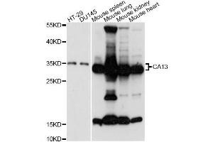 Western blot analysis of extracts of various cell lines, using CA13 antibody (ABIN6292753) at 1:3000 dilution. (CA13 抗体)