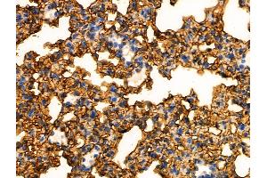 Phospho-RapGEF1 (Tyr504) Antibody at 1/100 staining Mouse lung tissue by IHC-P.