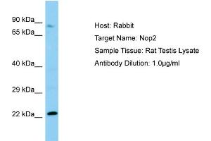 WB Suggested Anti-Nop2 Antibody   Titration: 1. (Nucleolar Protein 1 (NOL1) (N-Term) 抗体)