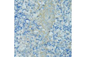 Immunohistochemistry of paraffin-embedded human tonsil using TJP2 antibody (ABIN5970222) at dilution of 1/100 (40x lens). (TJP2 抗体)