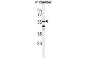 Western Blotting (WB) image for anti-SHQ1 Homolog (SHQ1) antibody (ABIN2996338) (SHQ1 抗体)