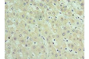 Immunohistochemistry of paraffin-embedded human liver tissue using ABIN7159904 at dilution of 1:100 (TIMM21 抗体  (AA 1-248))