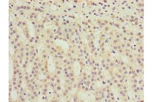 Immunohistochemistry of paraffin-embedded human adrenal gland tissue using ABIN7173199 at dilution of 1:100 (TMEM31 抗体  (AA 1-118))
