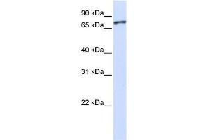 UNC5A antibody used at 1 ug/ml to detect target protein. (UNC5A 抗体)
