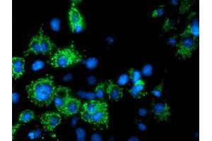 Anti-AK4 mouse monoclonal antibody (ABIN2454868) immunofluorescent staining of COS7 cells transiently transfected by pCMV6-ENTRY AK4 (RC220572). (AK4 抗体)