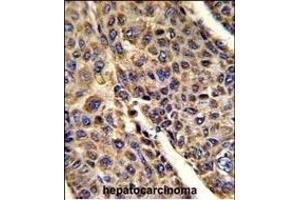Immunohistochemistry (Paraffin-embedded Sections) (IHC (p)) image for anti-Voltage-Dependent Anion Channel 1 (VDAC1) (AA 1-30), (N-Term) antibody (ABIN390563)