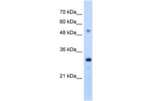 Western Blotting (WB) image for anti-PSME3 (PSME3) antibody (ABIN2462949) (PSME3 抗体)