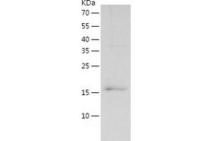 Western Blotting (WB) image for Cardiac Troponin C (TNNC1) (AA 1-161) protein (His tag) (ABIN7122145) (TNNC1 Protein (AA 1-161) (His tag))