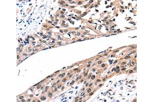 Immunohistochemistry (IHC) image for anti-Gap Junction Protein, beta 2, 26kDa (GJB2) antibody (ABIN2425961) (GJB2 抗体)