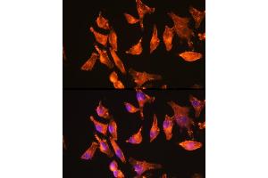 Immunofluorescence analysis of HeLa cells using α-Actin-1  Rabbit mAb (ABIN3015986, ABIN3015987, ABIN1680683 and ABIN1680684) at dilution of 1:100 (40x lens). (Actin 抗体)