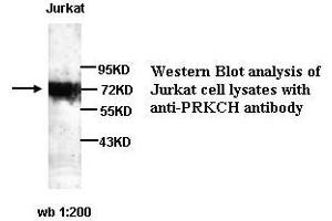 Image no. 1 for anti-Protein Kinase C, eta (PRKCH) antibody (ABIN790881) (PKC eta 抗体)