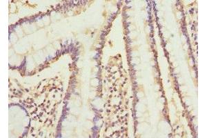 Immunohistochemistry (IHC) image for anti-Cytochrome P450, Family 2, Subfamily C, Polypeptide 18 (CYP2C18) (AA 231-490) antibody (ABIN7149242)