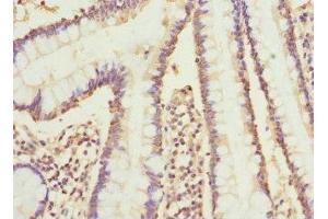 Immunohistochemistry of paraffin-embedded human small intestine tissue using ABIN7149242 at dilution of 1:100 (CYP2C18 抗体  (AA 231-490))