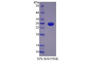Image no. 1 for Interleukin 12 alpha (IL12A) (AA 26-215) protein (His tag) (ABIN6236554) (IL12A Protein (AA 26-215) (His tag))