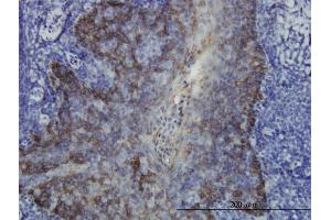 Immunoperoxidase of monoclonal antibody to KRT17 on formalin-fixed paraffin-embedded human tonsil. (KRT17 抗体  (AA 1-432))