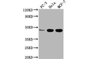 Western Blot Positive WB detected in: PC-3 whole cell lysate, Hela whole cell lysate, MCF-7 whole cell lysate All lanes: CCDC74B antibody at 1:2000 Secondary Goat polyclonal to rabbit IgG at 1/50000 dilution Predicted band size: 42, 36 kDa Observed band size: 42 kDa (CCDC74B 抗体  (AA 1-257))