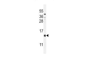 CCD Antibody (C-term) (ABIN654802 and ABIN2844477) western blot analysis in mouse liver tissue lysates (35 μg/lane). (CCDC126 抗体  (C-Term))