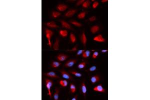 Immunofluorescence analysis of U2OS cells using PPARD antibody. (PPARD 抗体)