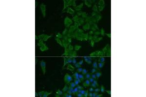 Immunofluorescence analysis of MCF7 cells using LGALS3BP Polyclonal Antibody (LGALS3BP 抗体)