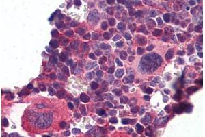 Mouse Lymphoid Tissue: Formalin-Fixed, Paraffin-Embedded (FFPE) (KLF2 抗体  (N-Term))