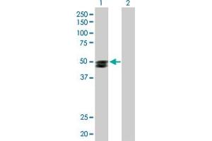 Western Blot analysis of SMPDL3B expression in transfected 293T cell line by SMPDL3B MaxPab polyclonal antibody. (SMPDL3B 抗体  (AA 1-373))